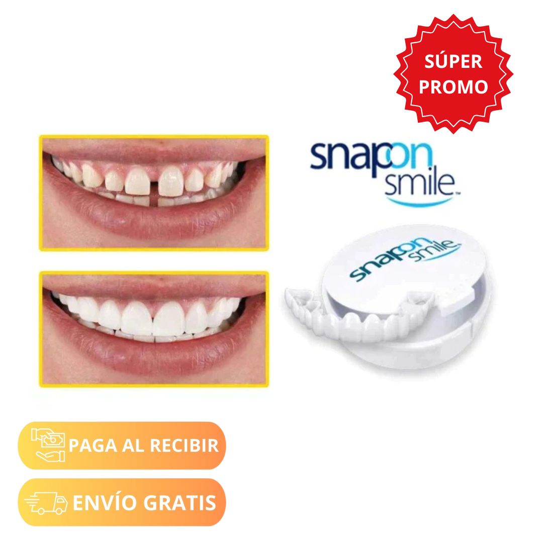 Carillas Dentales Luxury Smile