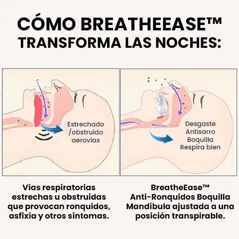 BreatheEase™ boquilla antirronquidos